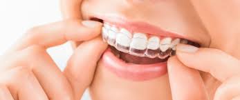 retainer